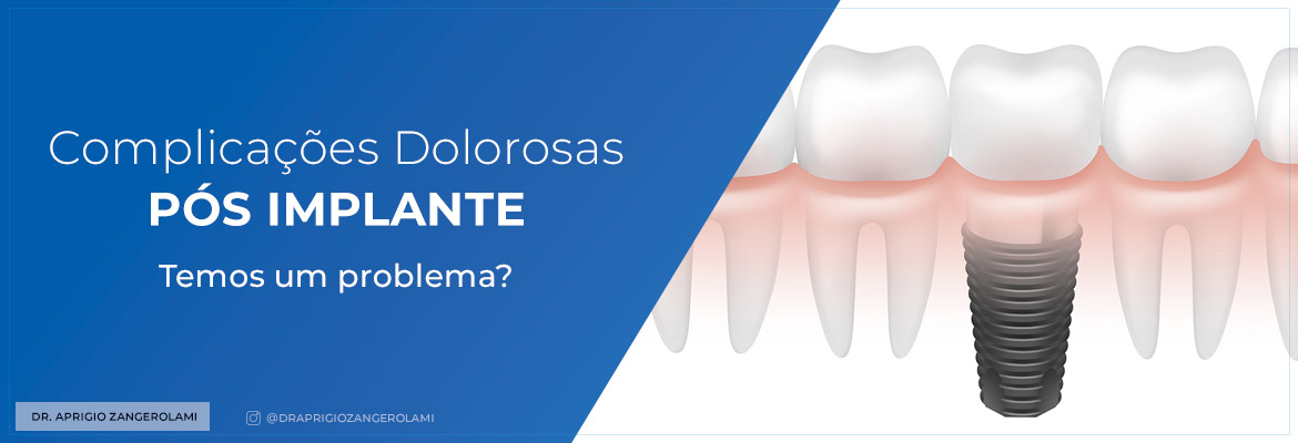 Complicações Dolorosas Pós Implante